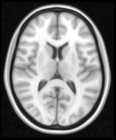 Axial brain MRI