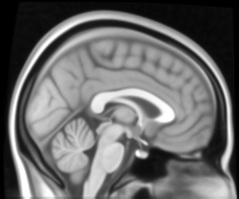 Sagittal brain MRI